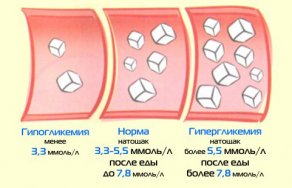 Сахар на верхней границе нормы нормы