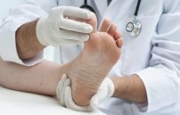 Посинел палец на ноге при сахарном диабете: лечение
