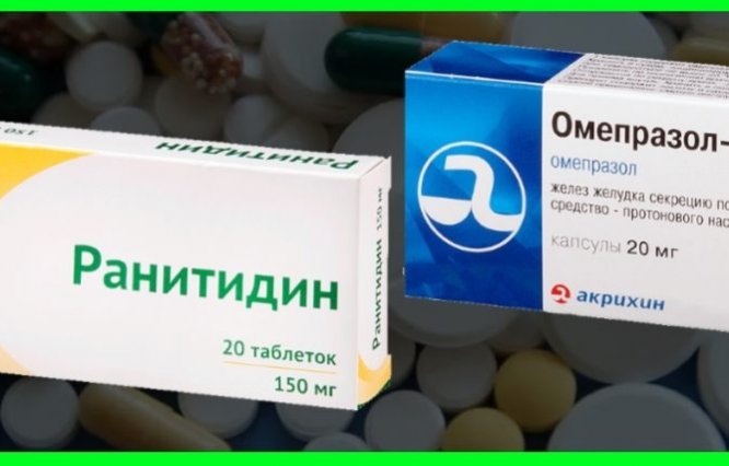 Что лучше Ранитидин или Омепразол