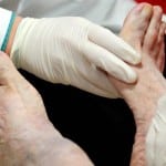 причины амиотрофии