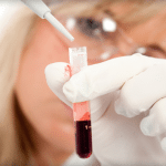 Как правильно подготовиться к сдаче анализа крови на сахар и холестерин thumbnail