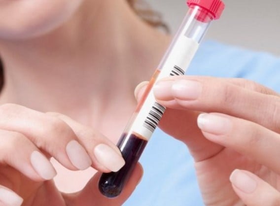 исследование уровня инсулина плазмы крови