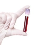 Экспресс анализ крови на сахар: цена тест полосок