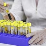 Лабораторные исследования в диагностике сахарного диабета Лабораторные исследования в диагностике сахарного диабета thumbnail