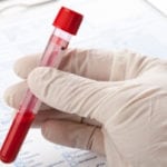 Общий анализ крови обнаруживают сахар в крови thumbnail