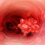 Как почистить кровь при диабете thumbnail