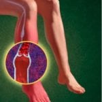 Посинел палец на ноге при сахарном диабете: лечение