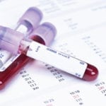 Экспресс анализ крови на сахар: цена тест полосок