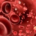 Как взаимосвязаны холестерин и СОЭ в крови?