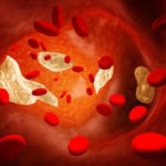 Методы определения общего холестерина в крови