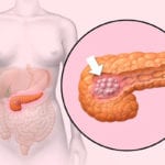 Экзокринная и эндокринная функция поджелудочной железы функции поджелудочной железы thumbnail