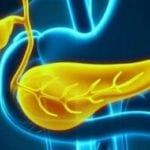 Синдромы при панкреатите поджелудочной железы thumbnail