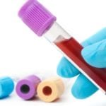Экспресс анализ на холестерин: как правильно сдавать кровь?