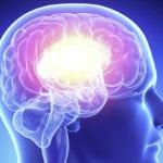 Атеросклероз головного мозга продолжительность жизни thumbnail